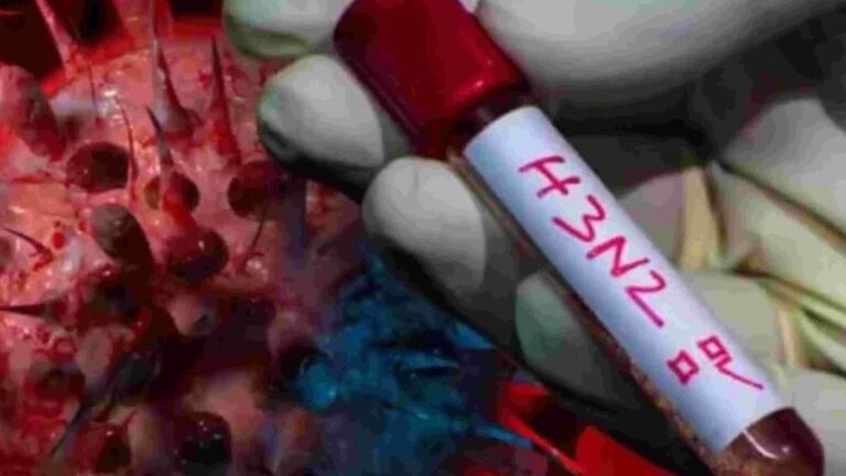 Súper gripe H3N2: qué es, cuáles son los síntomas y cómo se trata, según un médico especializado