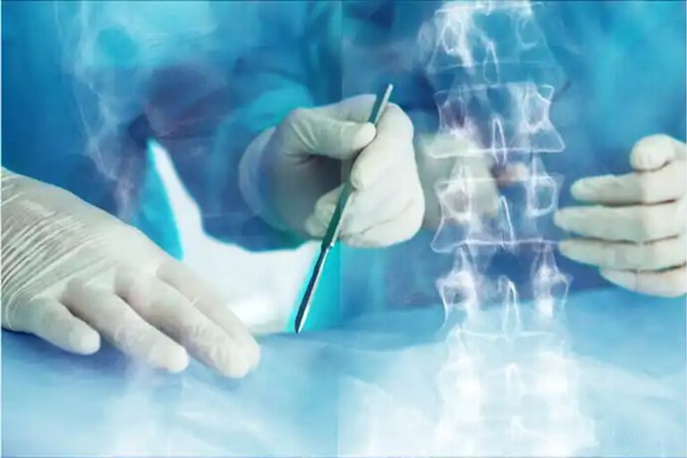 Equipo médico realizando una cirugía de columna asistida por robot en un quirófano moderno.